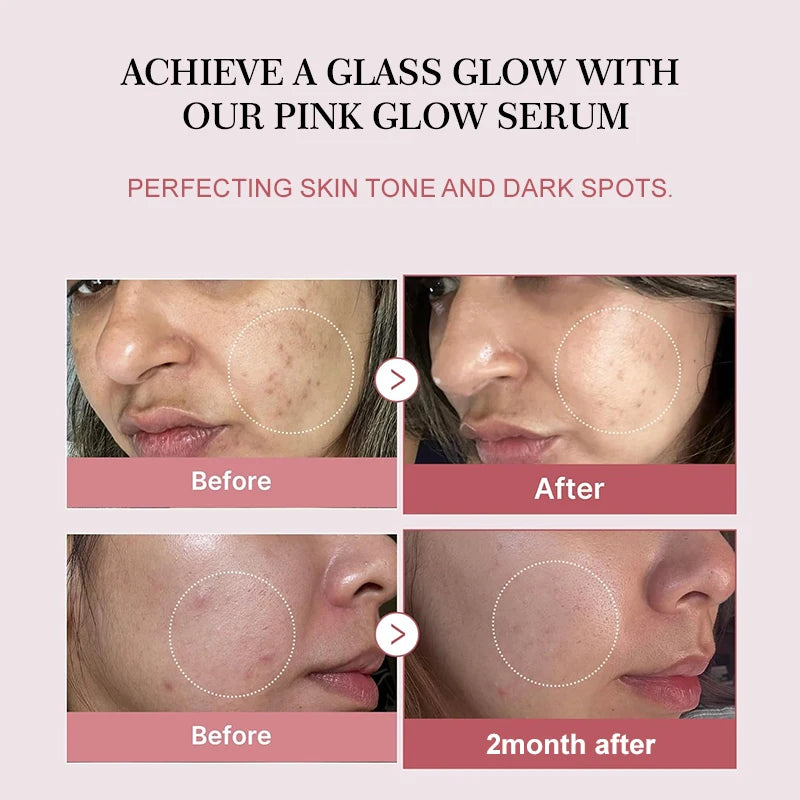 Pink Glow Sérum PDRN
